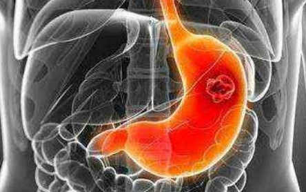 3N)HWXTKXV9UYOX{FNHA@5T.png 3N)HWXTKXV9UYOX{FNHA@5T.png