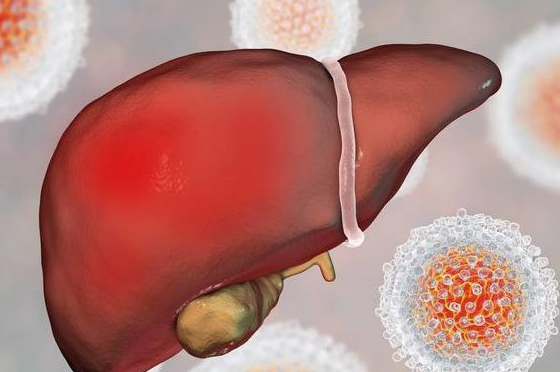 肝癌