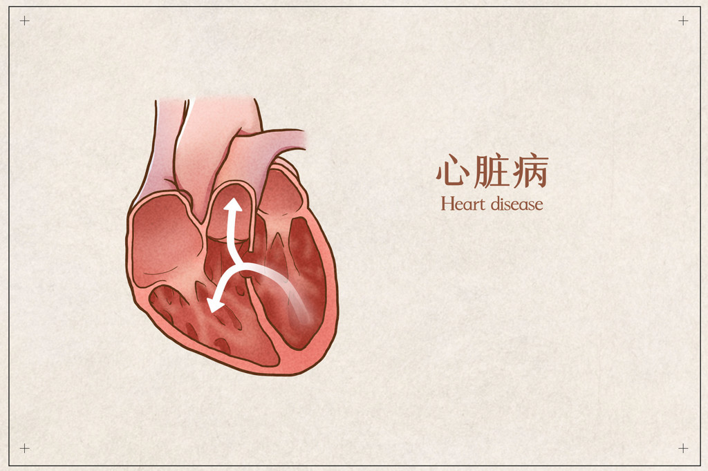 心脏外科医院排名