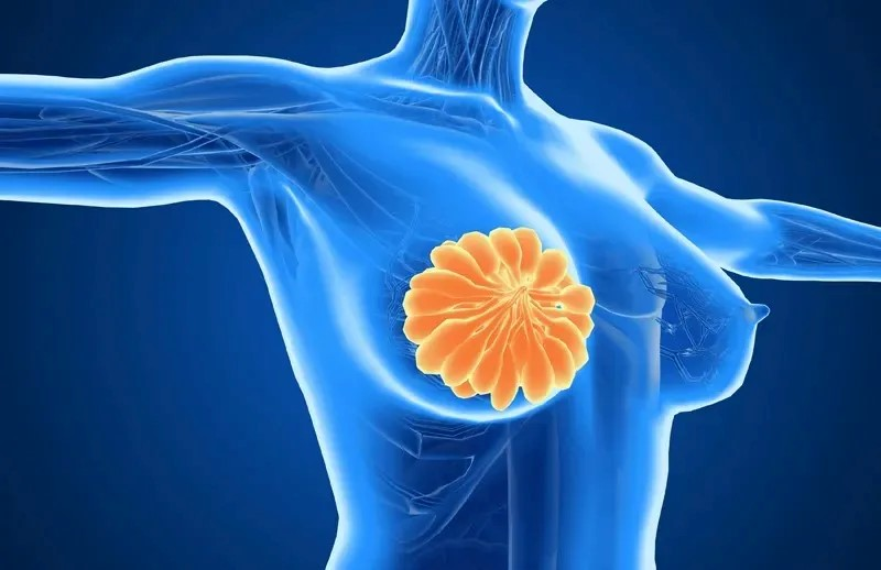 欧洲新研究：Ribociclib联合疗法用于乳腺癌术后辅助治疗，安全又有效！