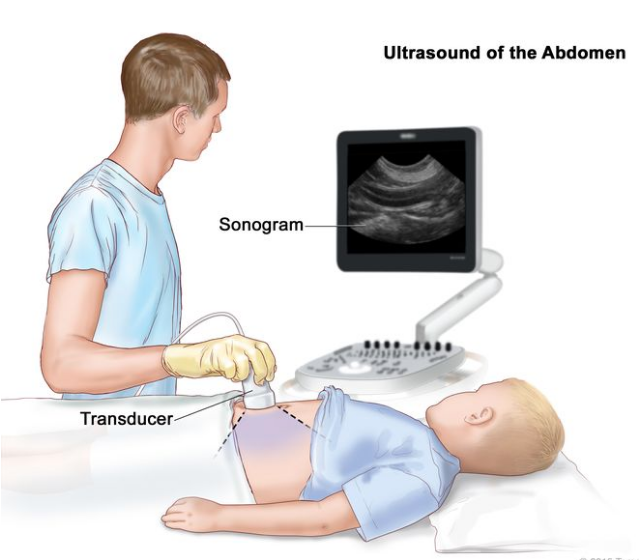 放大腹部超声检查；图画显示，一名儿童在接受腹部超声检查时躺在检查台上。图中，一名技术人员将换能器（一种发出声波的设备，声波在体内组织上反射）按压在腹部皮肤上。计算机屏幕显示超声波图（图片）。