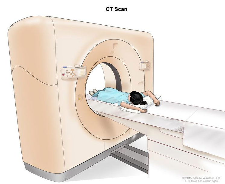 计算机断层扫描 (CT)；图画显示一名儿童躺在一张桌子上，桌子滑过 CT 扫描仪，扫描仪会对其身体内部区域进行一系列详细的 X 射线照片。