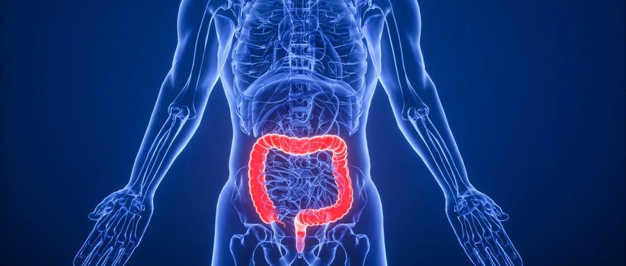 结直肠癌出国看病治愈率与国家选择 结直肠癌出国看病治愈率与国家选择