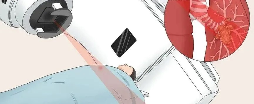 美国质子治疗全指南:精准抗癌的利器与赴美就医之路 美国质子治疗全指南:精准抗癌的利器与赴美就医之路