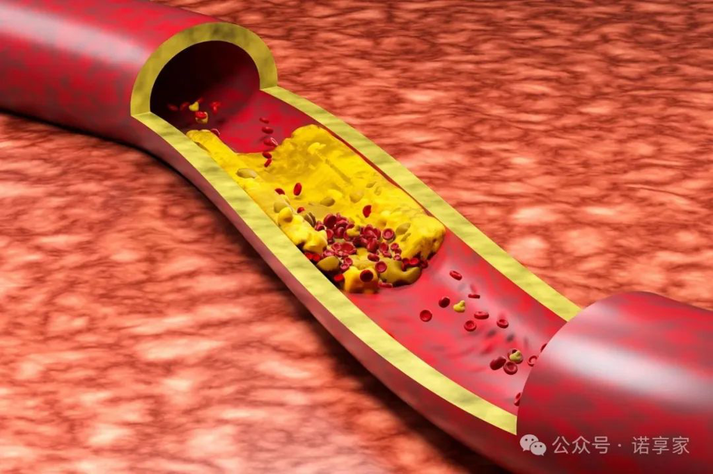 心血管