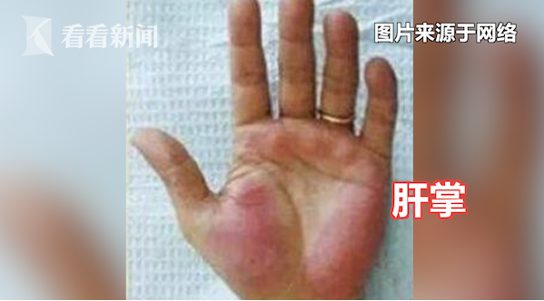 微信图片_20210106112601.png