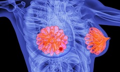 FDA批准扩大阿贝西利适应症，早期乳腺癌也可用！
