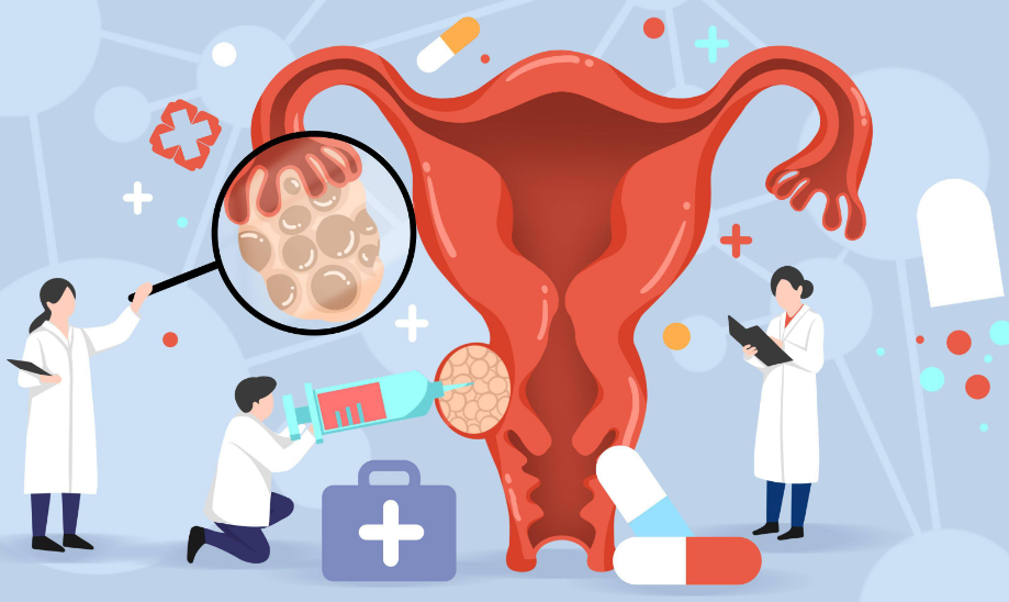 卵巢癌的病因和症状有哪些？如何治疗卵巢癌？
