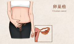 42.3%的患者肿瘤显著缩小或完全消失，卵巢癌前沿药Elahere获欧盟批准