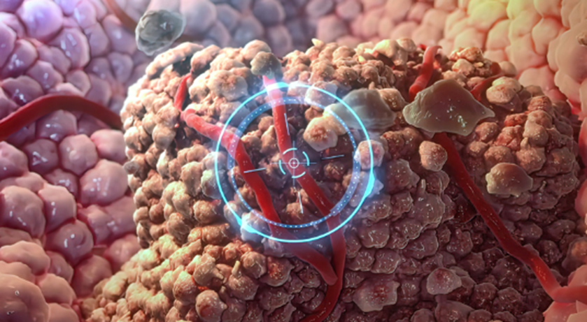 胰腺癌治疗：化疗几十年没重大突破，这款新靶向药或能改写“游戏规则”？