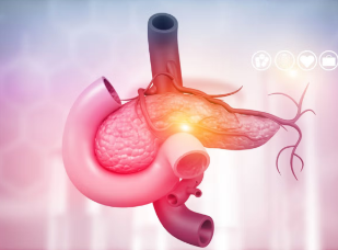 晚期胰腺癌逆袭？新型四联疗法控癌时间达历史数据两倍！