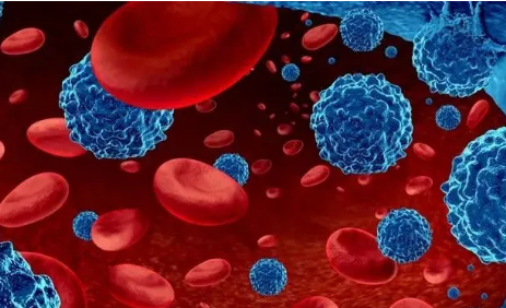 弥漫大B细胞淋巴瘤患者迎来新希望,13位患者100%肿瘤全消失!