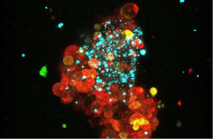 ER+乳腺癌患者福音！科学家发现，“扒掉”癌细胞的“隐身衣”，免疫治疗就可能变得有效！