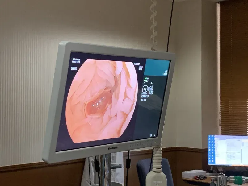 一级致癌物超标9000多倍，不少人天天戴！9.9的廉价首饰，可能正在“侵蚀”你的健康