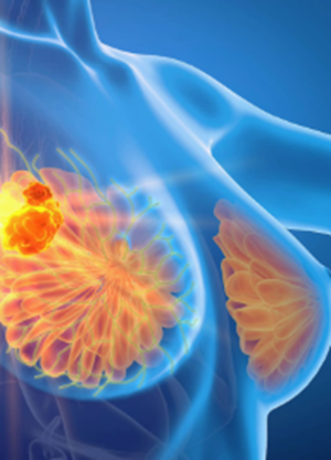 晚期乳腺癌患者的福音：终于有望告别“化疗必须受大罪”的困境！