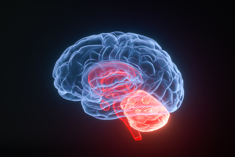 一名胶质母细胞瘤患者活过3年！新型细胞疗法Temferon刷新生存记录