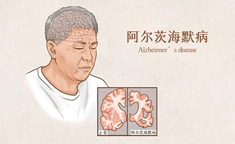 研究显示：阿尔茨海默病的“幕后黑手”，竟也是肺癌脑转移“帮凶”！