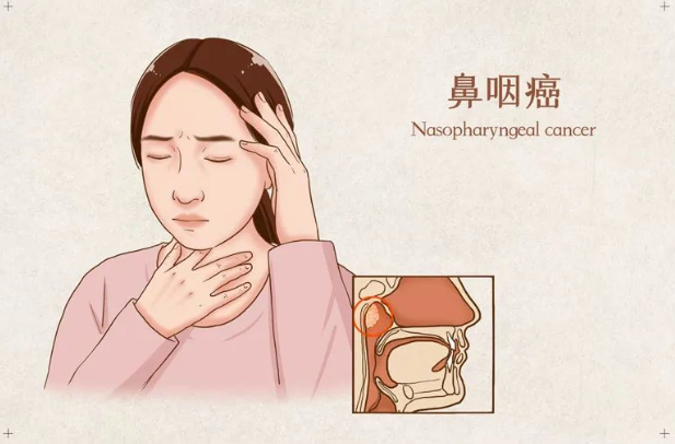知名博主抗癌5年不幸离世：超四成这种癌发生在中国，该如何应对？一文读懂