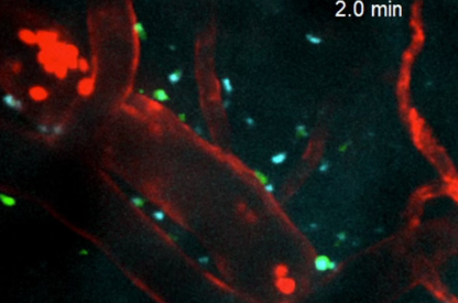 一针修复中风后脑损伤？美国西北大学研发的再生纳米药物，究竟有何神奇之处？