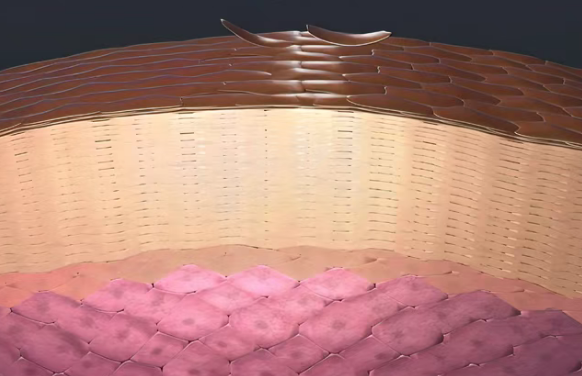美国耶鲁癌症中心就医案例：晚期黑色素瘤患者通过TIL疗法实现临床治愈