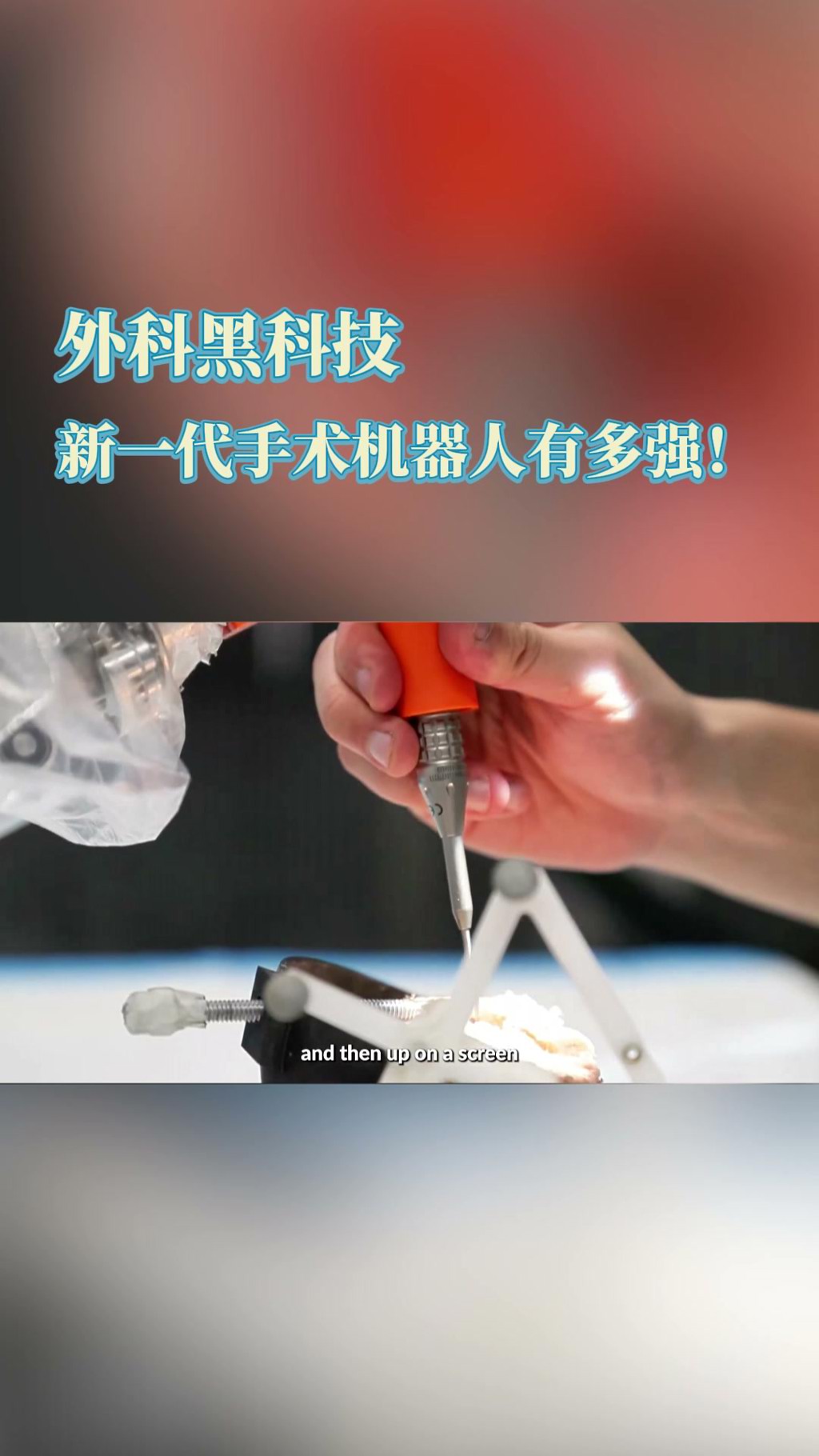 美国约翰·霍普金斯医院：新一代手术机器人的应用实例