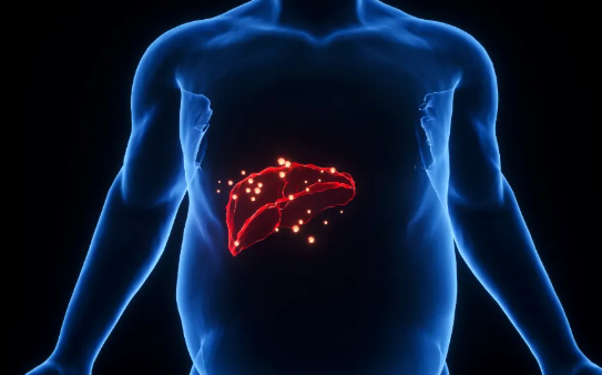 50-59岁男性企业家群体，脂肪肝检出率超66%！盛诺一家健康管理服务帮您未雨绸缪