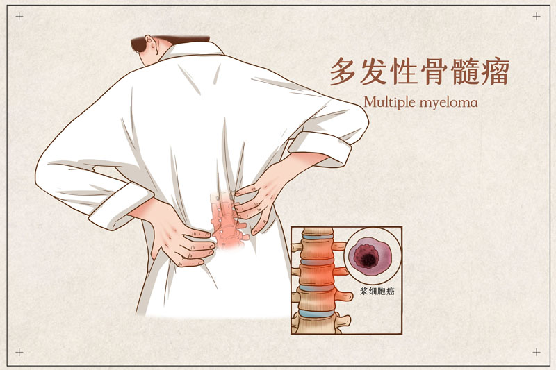 多发性骨髓瘤治疗新高度：CAR-T疗法实现100%患者治疗有效，其中90%的人实现“查无此癌”！