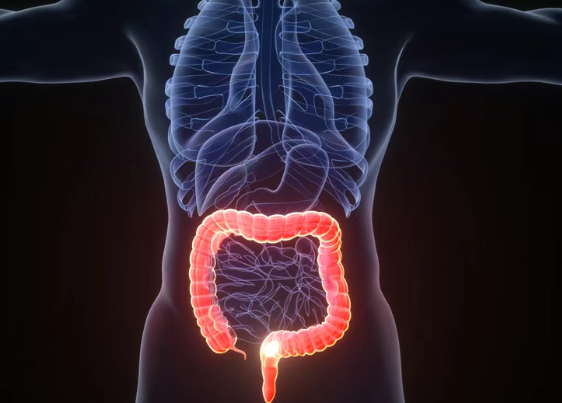 39.3%患者肿瘤明显缩小或消失！HER2阳性转移性结直肠癌迎来“无化疗”新方案