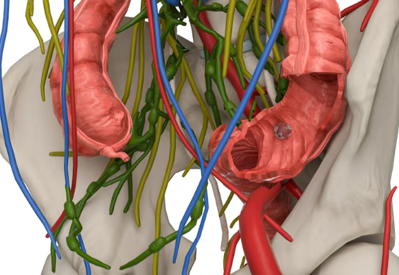 美国MD安德森医院直肠癌治疗新策略：超过一半患者有机会避免手术，治愈机会更大！
