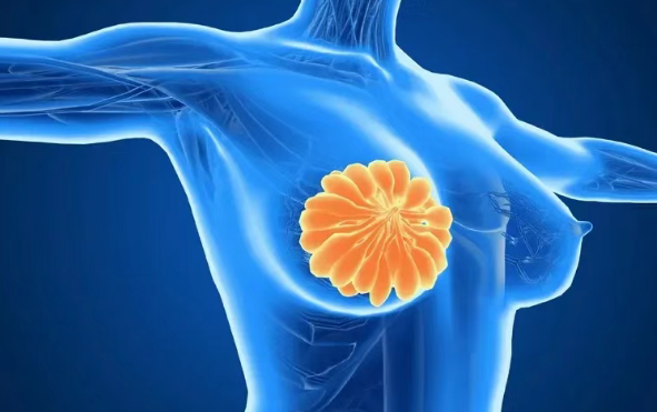 全球新药前沿：乳腺癌新药T-DXd术后方案，让92.4%患者3年内不复发！