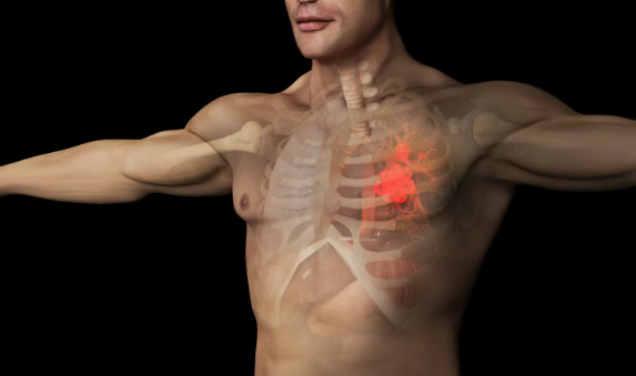 71%患者肿瘤明显缩小或消失！JNJ-1900联合放化疗+免疫治疗，针对Ⅲ期肺癌取得突破