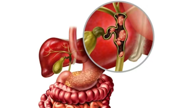 难治性胆道癌缓解率提升两倍多！美国FDA授予Tovecimig(CTX-009)孤儿药资格认定