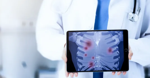 双肺多发“毫米级”肺结节,怎么判断是不是癌?美国哈佛教授远程会诊给出解答!