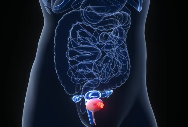 美国上市新药：CT-P71获FDA快速通道资格，用于局部晚期或转移性尿路上皮癌