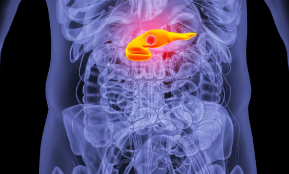 胰腺癌新突破！《Nature》重磅发布新药NP137临床数据：88%患者肿瘤缩小，23%患者重获手术机会