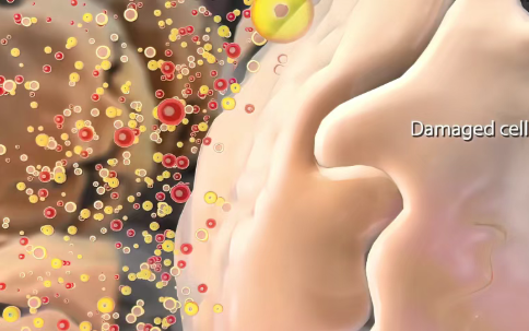 1/6癌症由炎症引起,抗炎防癌,普通人具体该怎么做?