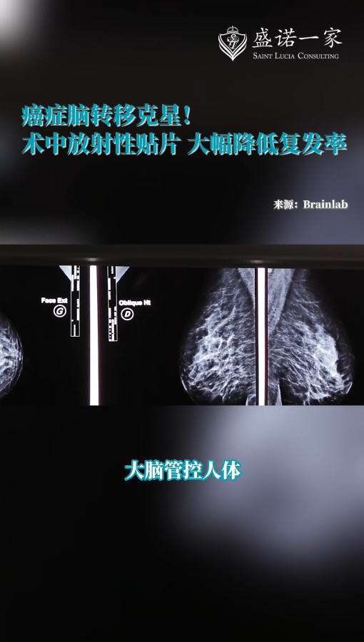 癌症脑转移克星！术中放射性贴片GammaTile大幅降低复发率